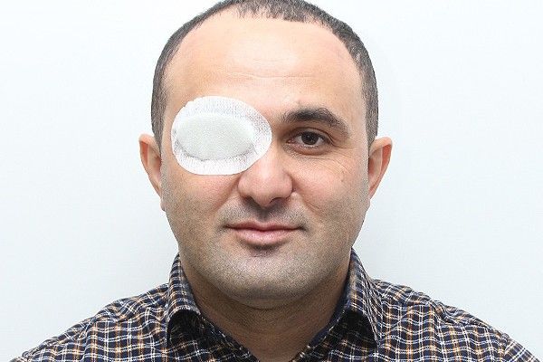 Former Azerbaijani soldier arrested for hooliganism